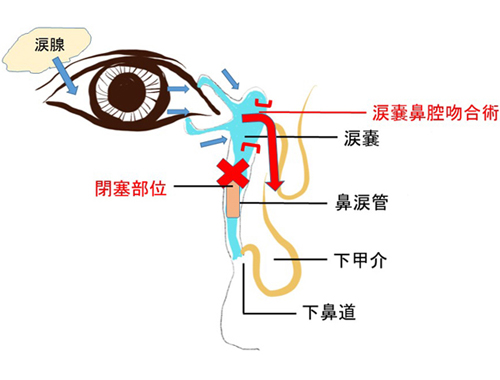 耳鼻いんこう科を詳しく知る 松本歯科大学